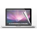 Xssive Screen Protector voor MacBook Pro met Retina 13 inch